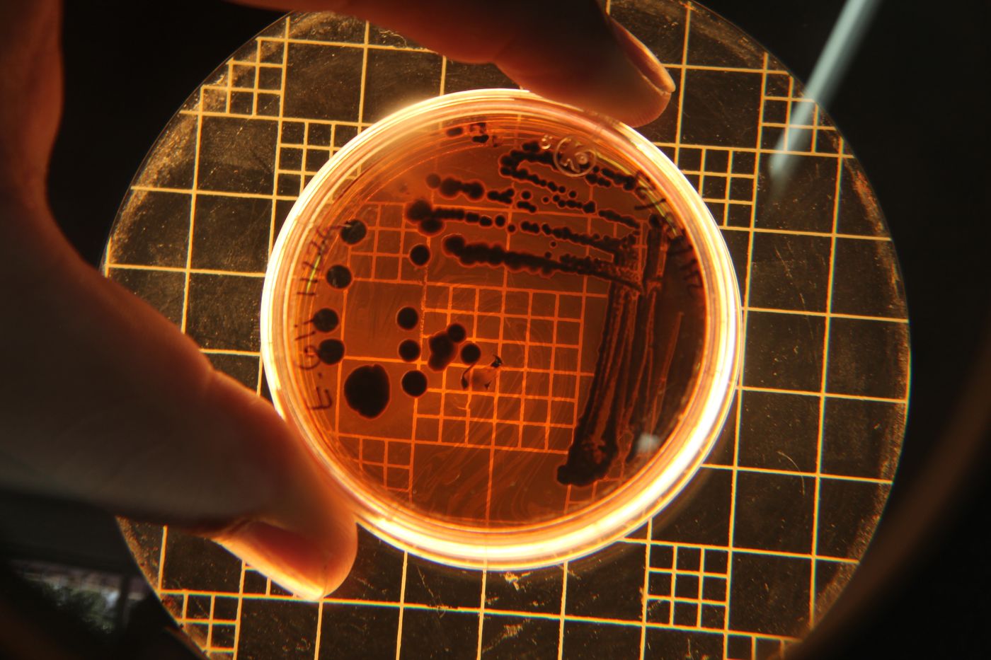 Colonies on a plate counted under a magnifier