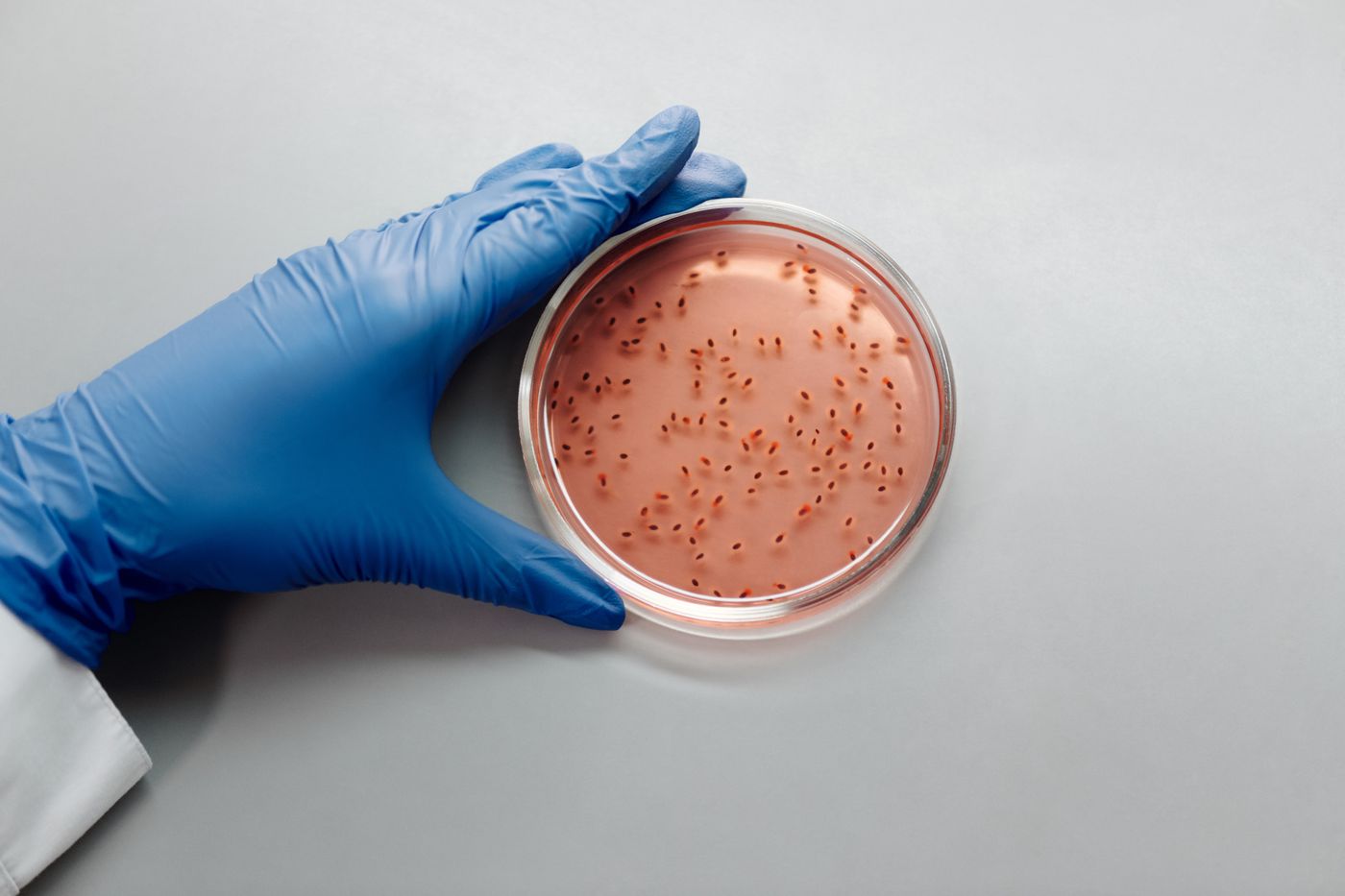 Bacterial colonies growing in a petri dish