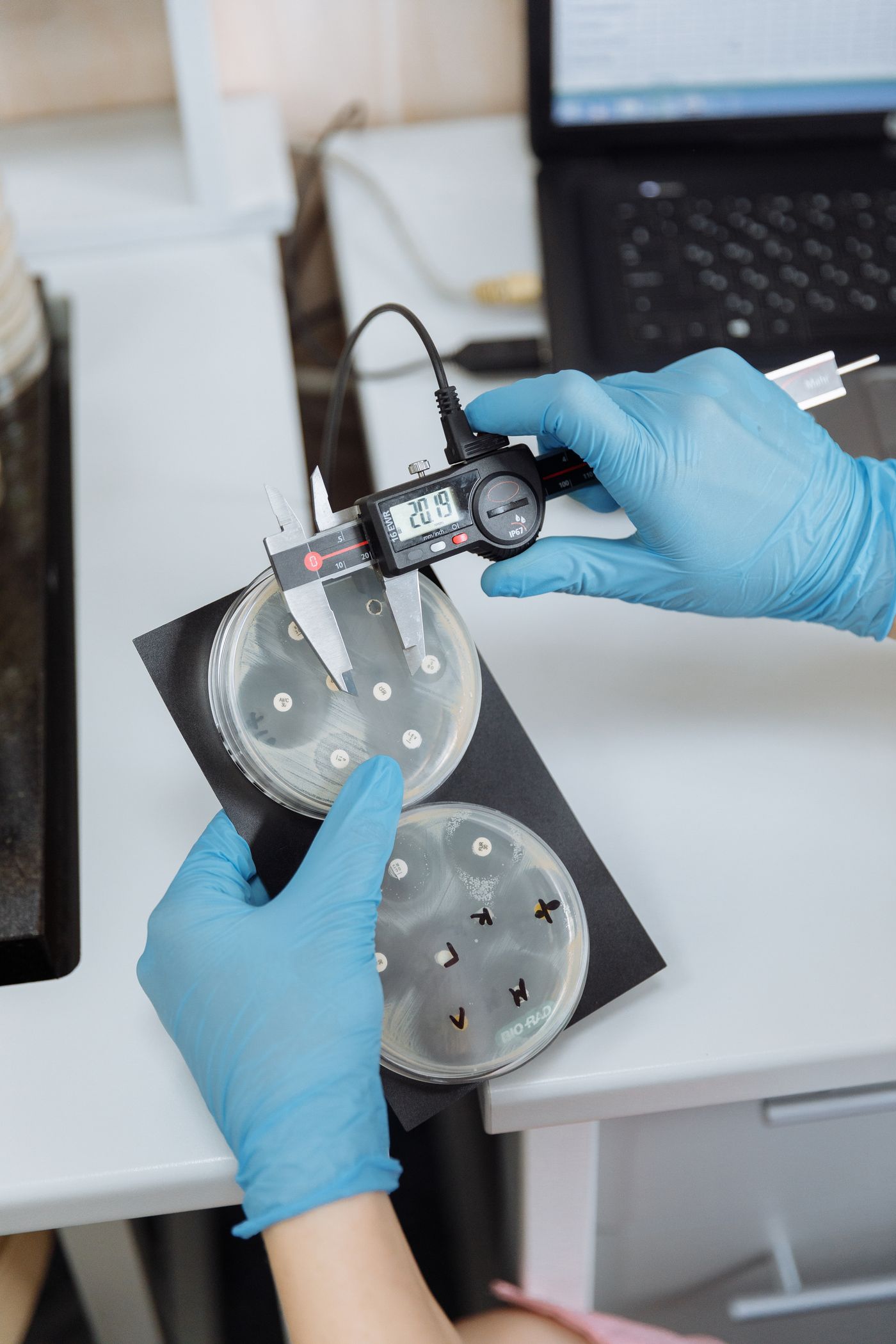 A scientist measuring a culture plate and logging the number